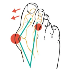 Compressana Tape Sox Hallux valgus