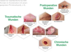 L+R Suprasorb P sensitive PU Schaumverband