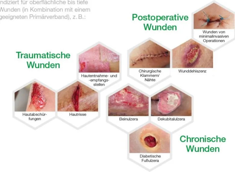 L+R Suprasorb P sensitive PU Schaumverband