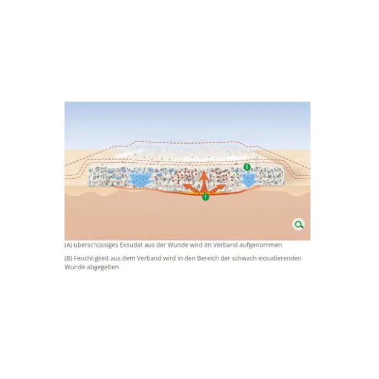 L+R Suprasorb X HydroBalance Wundverband