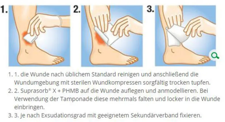 L+R Suprasorb X + PHMB Wundverband